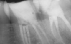 Endodontics